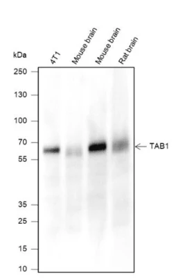 Anticuerpo monoclonal Tab1