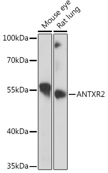 Anticuerpo policlonal Antxr2